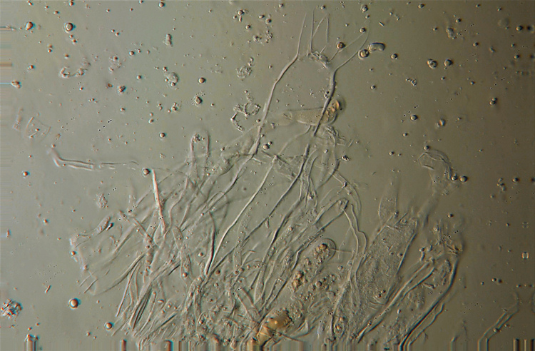 Aleurodiscus amorphus (Fr.)Schroeter